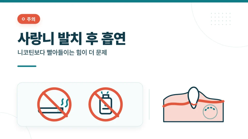 사랑니 발치 후 흡연 대표 이미지