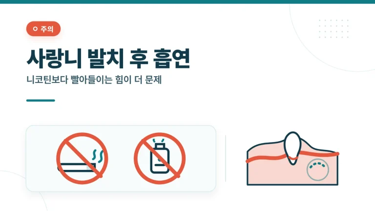 사랑니 발치 후 흡연 썸네일
